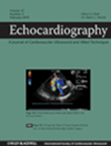 ECHOCARDIOGRAPHY-A JOURNAL OF CARDIOVASCULAR ULTRASOUND AND ALLIED TECHNIQUES雜志封面